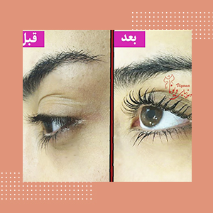 نمونه کار آموزشگاه زیبایی ویونا