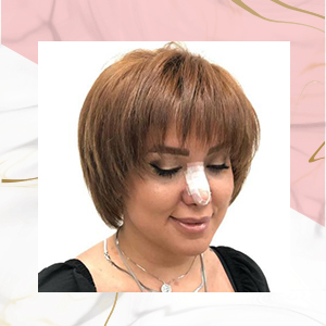 نمونه کار کوتاهی مو۱