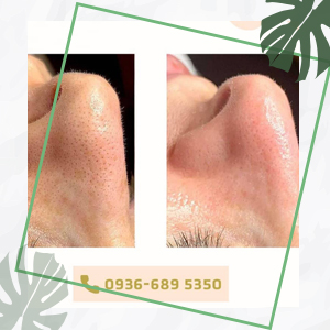 نمونه کار اشرف نظیفکار
