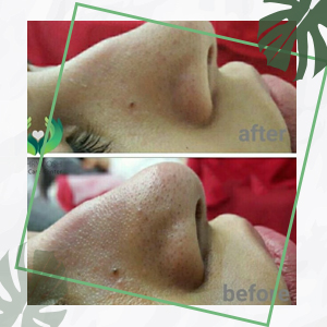 نمونه کار مهرنوش جعفرزاده